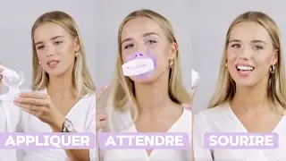 Meilleur Kit de blanchiment des dents en 2024 : Onlysmile