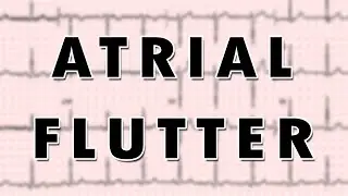 Atrial Flutter
