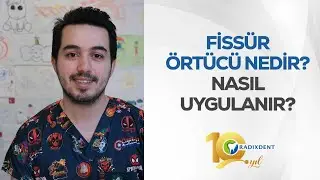 Fissür Örtücü Nedir? Nasıl Uygulanır?
