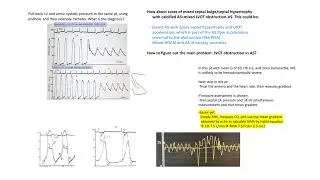 Hemodynamic cases- part 2
