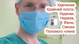 Removal of the foreskin, frenulum, nerves, veins, and ligaments of the penis / Dr. Cherepanov