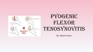 Pyogenic flexor tenosynovitis - epidemiology, causes, Kanavel signs, imaging, treatment