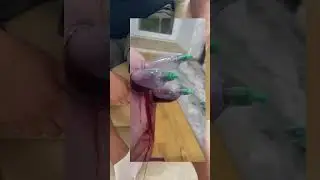❤️ОТ ОПУХОЛЕЙ И БОЛИ❤️