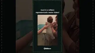 Qual sinal representativo desse vídeo? | Shorts EMR