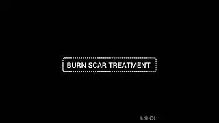 BURN SCAR TREATMENT - UNSIGHTLY/ BAD SCAR OVER FACE DUE TO BURNS IN CHILDHOOD.