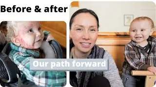 Integrative Eczema Approach | 13 month old infant | Aron Regimen | Dr. Sheila Kilbane | Story 2