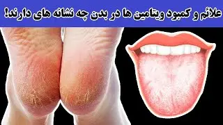 علائم و کمبود ویتامین ها در بدن چه نشانه های دارند!