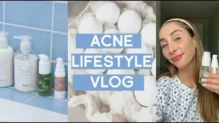 ACNE SPECIALIST | lifestyle vlog + acne tips.