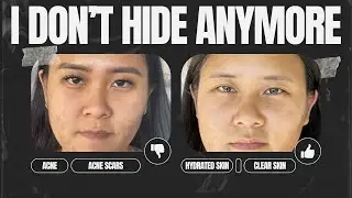 She Couldn’t Leave the House Without Makeup… Until This Happened