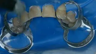 Кариес 12 22 EmpressDirect Syntec Sanctuary TorVM (прямой эфир)