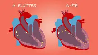 Difference between afib and atrial flutter || 60 second knowledge ||
