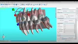 BlueSkyPlan Aligner Pricing Explained!