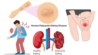 10 Early Warning Signs of Acute Kidney Failure You Shouldn't Ignore