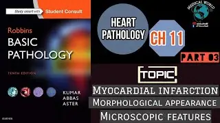 Myocardial Infarction | Morphological Appearance |Microscopic Features | Very Very Important