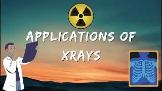 Applications of X-Rays | Radiotherapy Edutech #application #xray #xraytechnician #xrayclasses