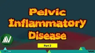 Pelvic inflammatory disease Masterclass Part2