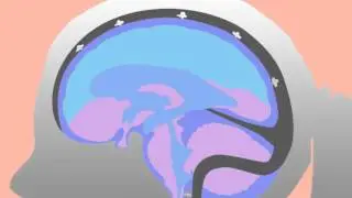 Cerebrospinal Fluid Flow by Tad Wanveer