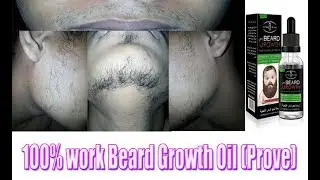 Beard growth oil for Beard Grow | Genuine Product | Beard Growth Oil 100% work (Prove)