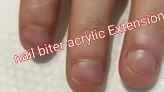 nail transformation nail biter #trending #nailart #nailextension #viralvideo #nailtutorial #tutorial