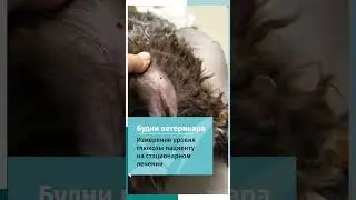 Глюкоза метрия