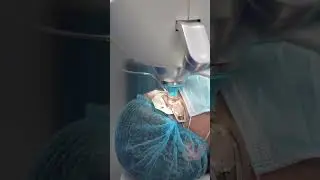 Liberate de tus lentes con la moderna cirugía láser para miopía y astigmatismo