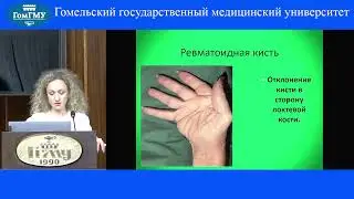 Жандарова Е.М. Особенности суставного синдрома при ревматоидном артрите и остеоартрите