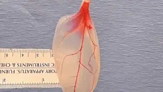 Now in Science: Spinach Leaves Turned Into Heart Tissue | #TWIBnation