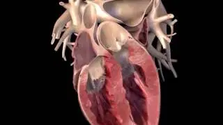 Zygote 3D Polygon Heart Model