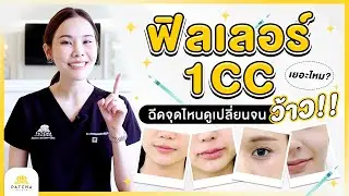 ฟิลเลอร์ 1 cc เยอะแค่ไหน ฉีดตรงไหนได้บ้างให้ดูว๊าว