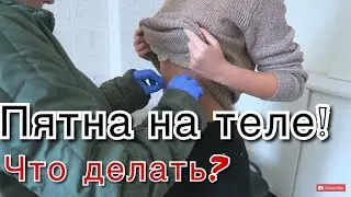 СЫПЬ! КРАСНЫЕ ПЯТНА НА ТЕЛЕ! ШОК КОНТЕНТ! СЛАБОНЕРВНЫМ НЕ СМОТРЕТЬ