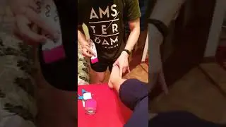 Тейпирование голеностопа (комбинированное)