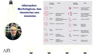 Alterações morfológicas das hemácias nas anemias