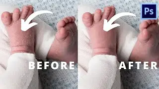 Save Time and Edit Dry/Peeling Skin Fast with This Photoshop Action