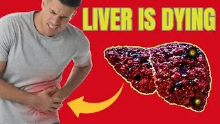 LIVER is DYING! 6 Weird Signs of LIVER DAMAGE  | Hab Healthy