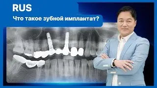 [Базовая имплантология] Что такое зубной имплантат?