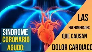 SÍNDROME CORONARIO AGUDO, Urgencias Cardiovasculares #1