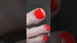 🧡✨ #педикюр #ногти #pedicure #paznokciehybrydowe #beforeandafter #nails #nailartist #wrocław
