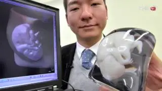When A 3D Printer Saved A Newborn Baby's Life!