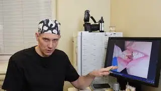 Стоматологический кейс | ИМПЛАНТАЦИЯ зубов