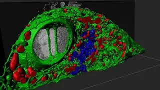 Automated image segmentation using CATS: EM interphase HeLa cell