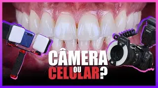 DENTAL PHOTOGRAPHY - WHICH CAMERA SHOULD I START WITH?
