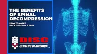 MD's Opinion on Spinal Decompression