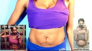 THINTEA REVIEWS – FLAT TUMMY