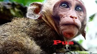 Oh mygod !! Some Pus on my CHIN Poor David so worry , His face so sad