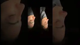 Revision Rhinoplasty For Crooked Nose and Facial Asymmetry : Before and After