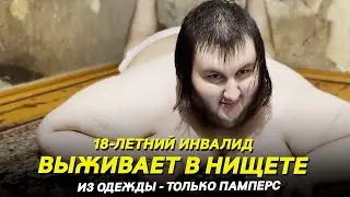 18-летний инвалид выживает в нищете!