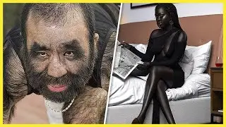 OS SERES HUMANOS MAIS RAROS QUE PODERIAM EXISITIR