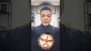 Nốt Ruồi Trên Mũi Tốt hay Xấu #tuongphap #nhantuonghoc #ngonhattang