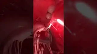 💓 Journey Through the Heart: From Outside to Inside 💓  