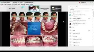 Biomecánica Racional en Ortodoncia Dr. Luciano Soldevilla